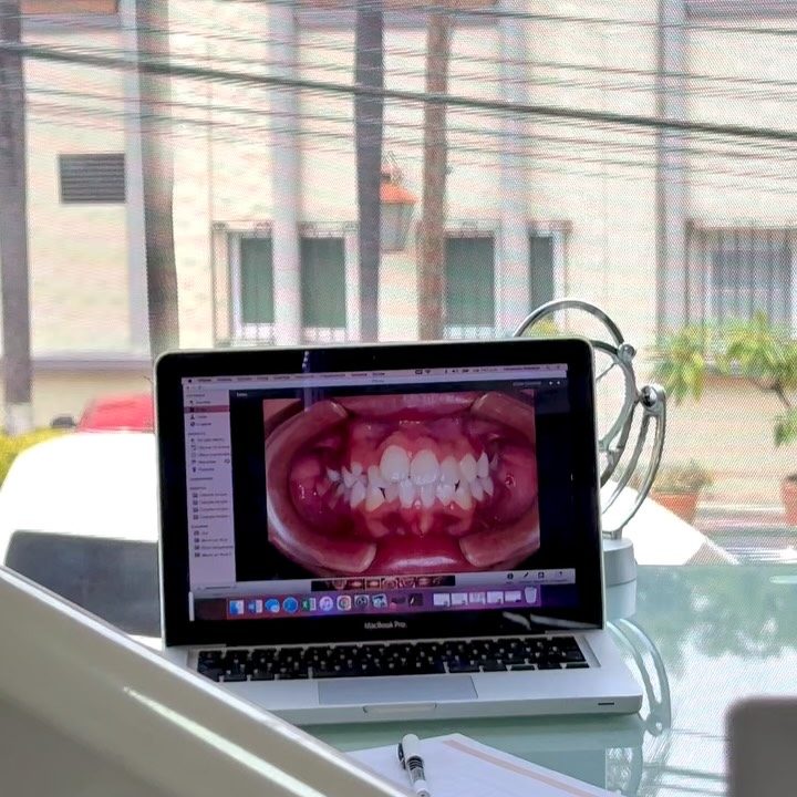 Fotografía clínica de una sonrisa revisada en pantalla en el consultorio